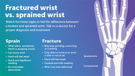 Signs Of A Broken Wrist