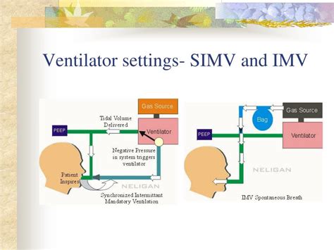 Simv In Ventilator