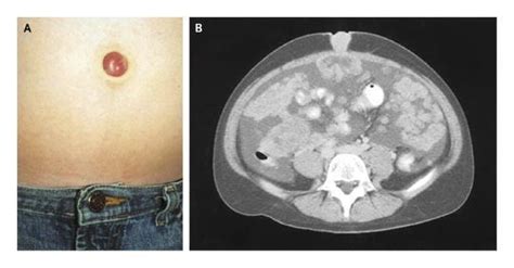 Sister Mary Joseph Sign