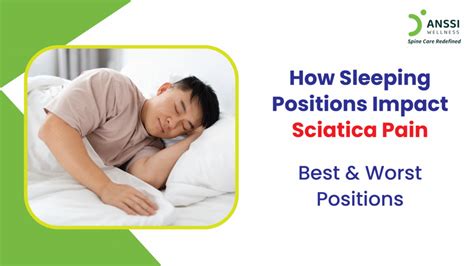 Sleeping With Sciatica