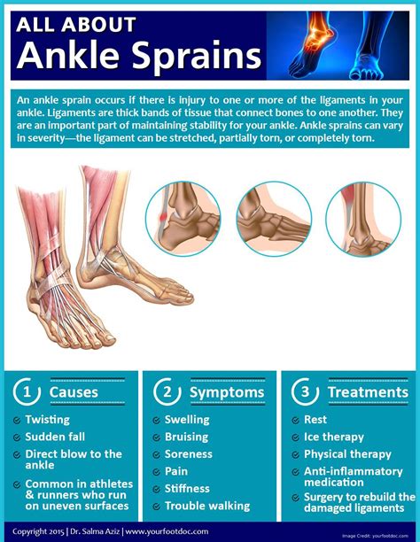 Sprained Ankle Signs