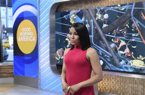 Stephanie Ramos Face Surgery