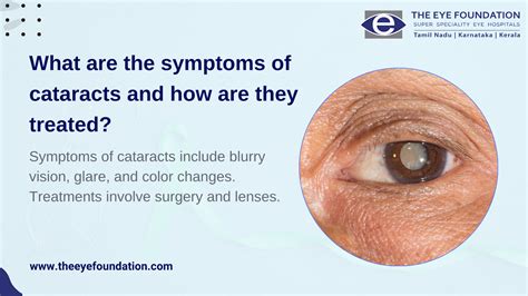 Symptoms Of Cataracts