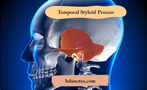 Temporal Styloid Process