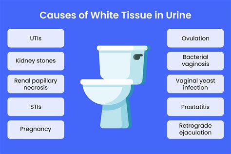 Tissue In Urine