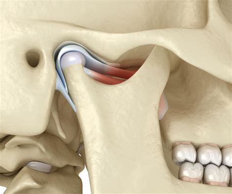 Tmj Operation Surgery
