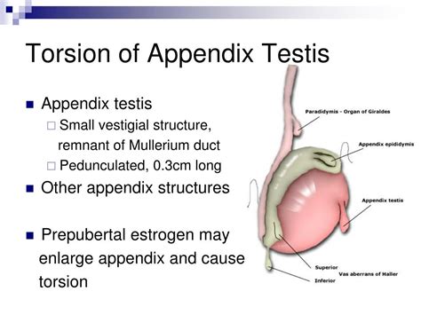 Torted Appendix Testis