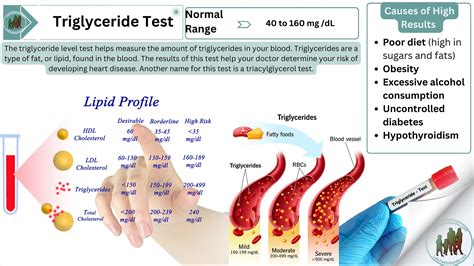 Triglycerides Lab Test