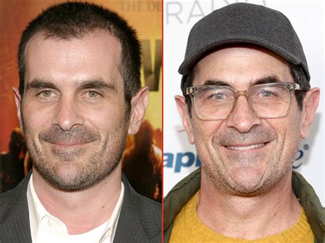 Ty Burrell Face Surgery