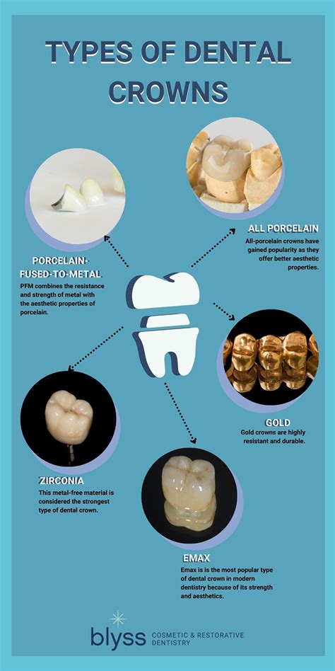 Types Of Crowns