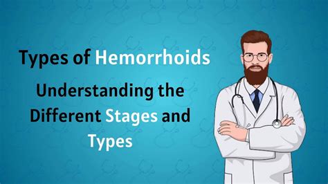 Types Of Hemorrhoids