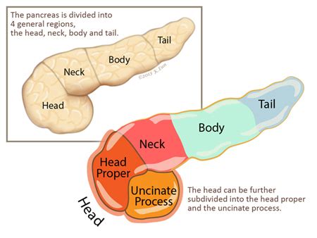 Uncinate Process Pancreas