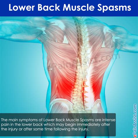 What Causes Back Spasms