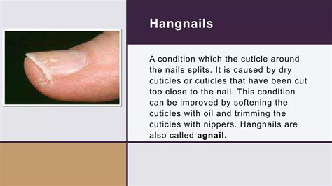 What Causes Hangnails