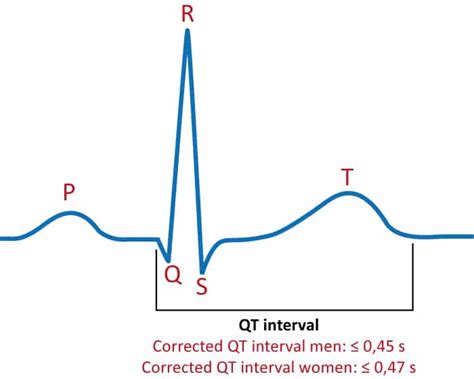 What Is Qt Interval