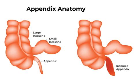 Where Is Located Appendix