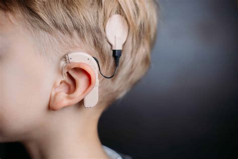 Why Cochlear Implants Are Bad