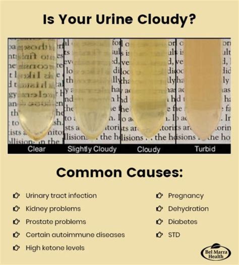 Why Is Urine Cloudy
