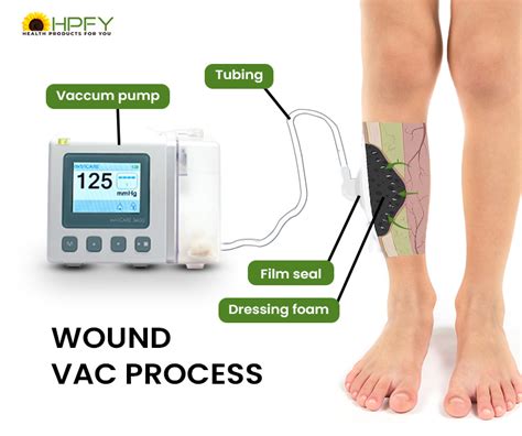 Wound Vac Machine