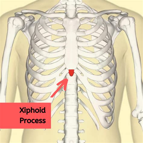 Xiphoid Process Lump